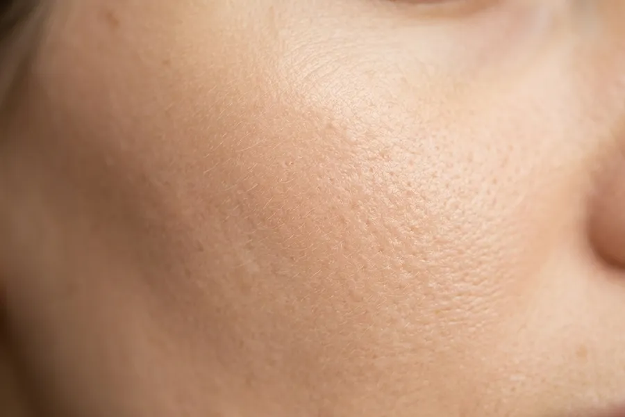 A close view of natural skin texture and pores on a cheek