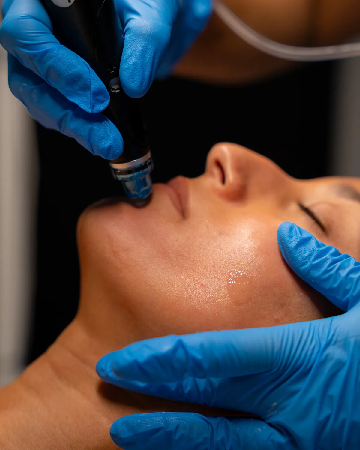 The HydraFacial handpiece gliding along a guest's jawline