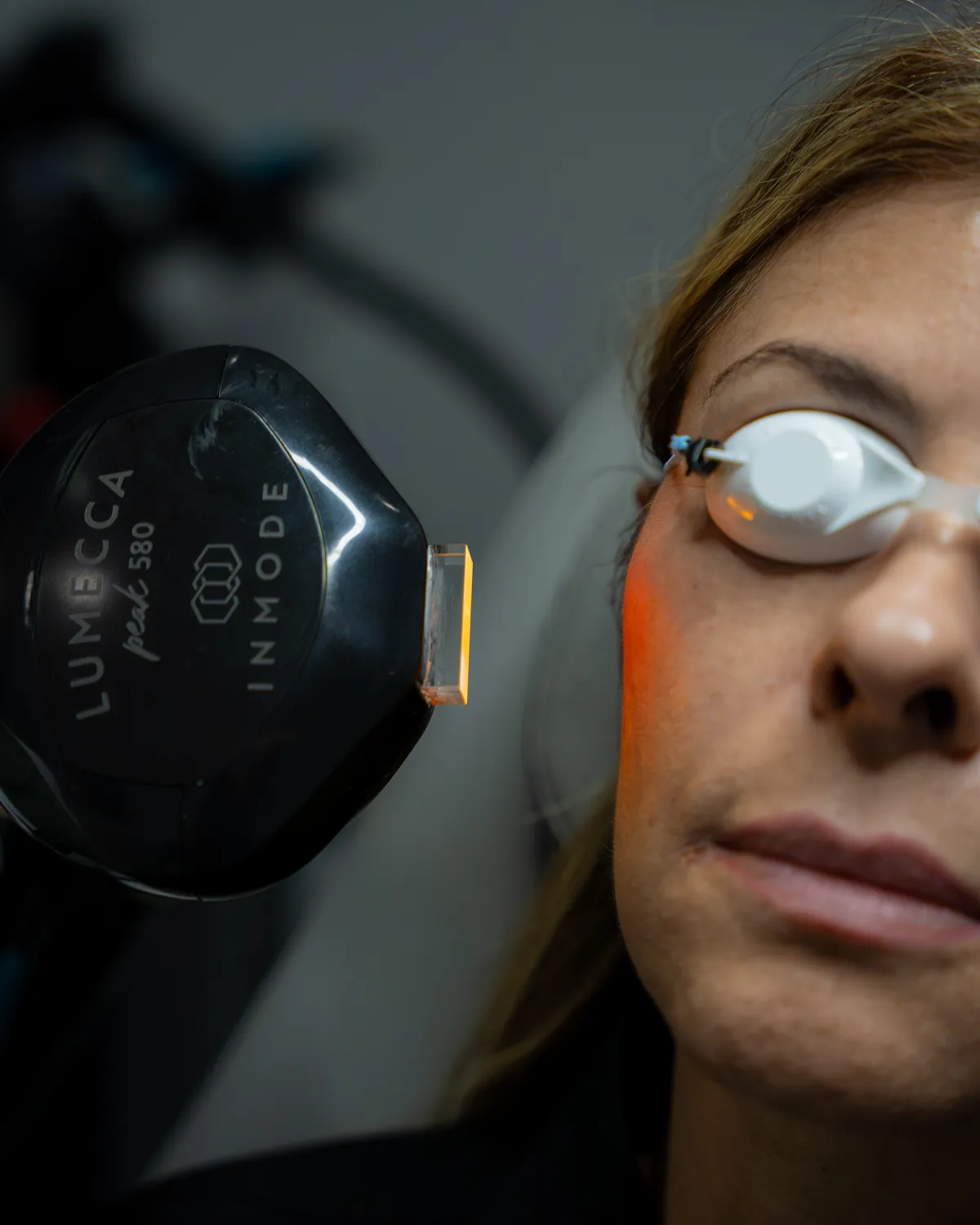 The Lumecca IPL handpiece beside a guest wearing protective eye shields